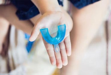 Schnarchschiene als Schnarchstopper
